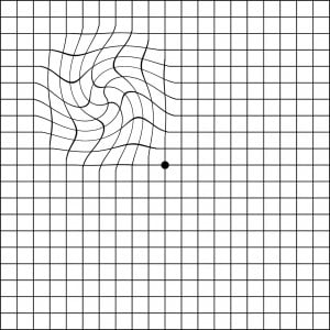 Distorted Amsler grid 