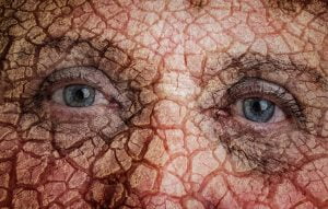 Aging of the population